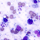Illustration for article titled Chagas: The Scary Disease Some Are Calling the New AIDS